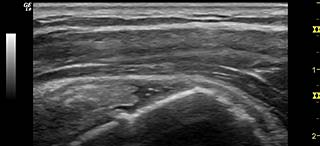 Musculoskeletal Ultrasound